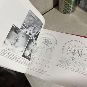 Normal Neuroradiology And Atlas of the Skull, Sinuses, and Facial Bones ，正常神经放射学 和颅骨（头骨）、鼻窦和面部骨骼图谱图集，大开本