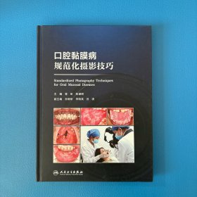 口腔黏膜病规范化摄影技巧