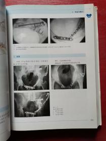 内固定支架：理念及LCP、LISS的临床应用