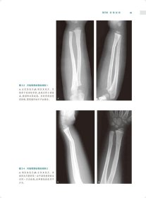 骨关节创伤X线诊断图谱（第4版） 9787117328548