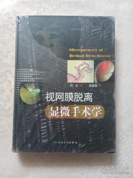 视网膜脱离显微手术学