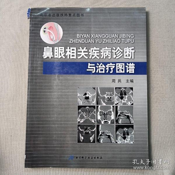 鼻眼相关疾病诊断与治疗图谱