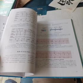 心脏起搏器现代功能详解