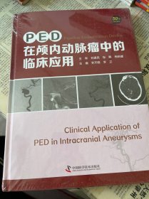 PED在颅内动脉瘤中的临床应用