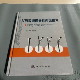 V形双通道脊柱内镜技术