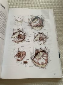 佐林格外科手术图谱（第9版）精装