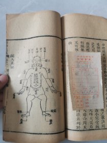 清 光绪28年刻本 《幼幼集成》六册一套全！首册封皮牌记有伤 前面2页序言有伤字，其余完整不缺！品相参图 大开本