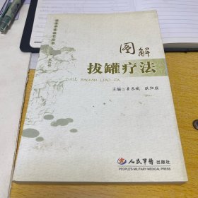 图解拔罐疗法
