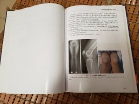 髌股关节不稳定·临床评估与治疗