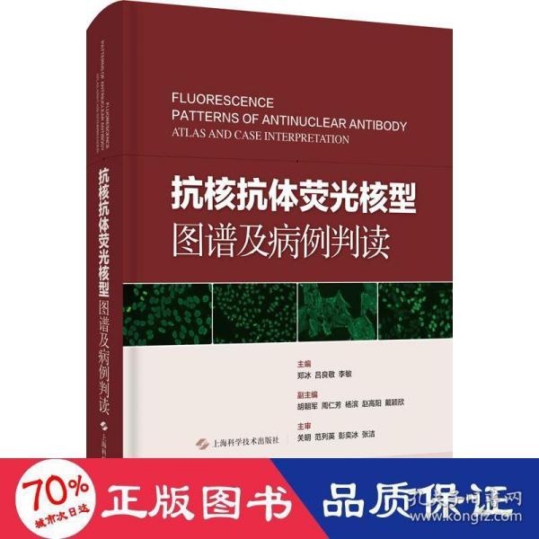 抗核抗体荧光核型图谱及病例判读