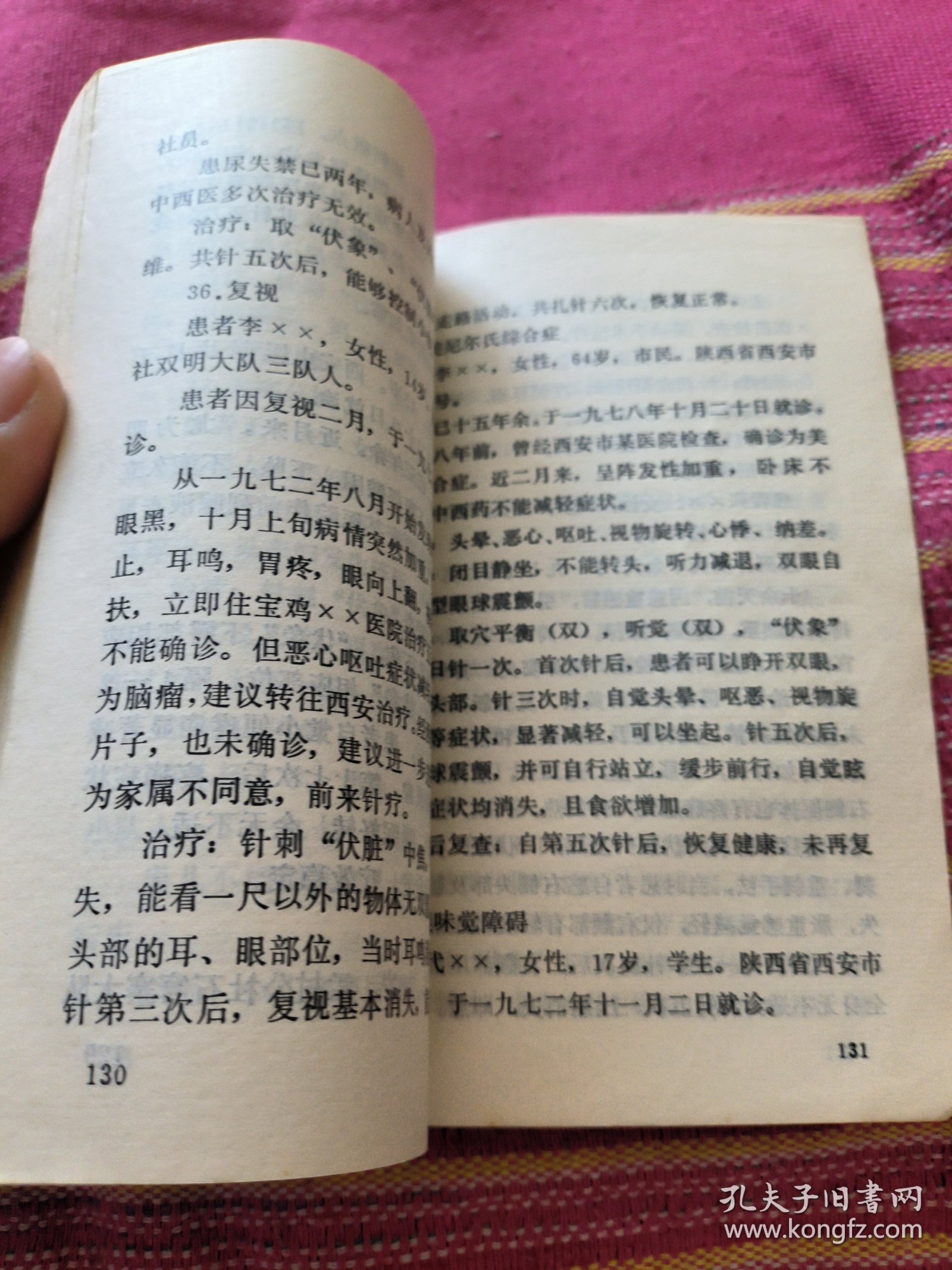 头皮针
