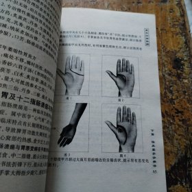 望手诊病图解