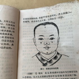 医宗金鉴幼科心法要诀白话解