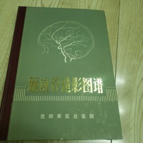 脑血管造影图谱