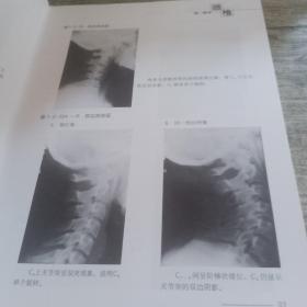 骨伤科影像读片解析：颈腰椎疾病