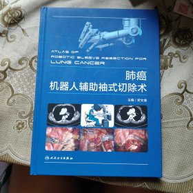 肺癌机器人辅助袖式切除术