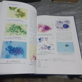 支气管肺泡灌洗液图谱