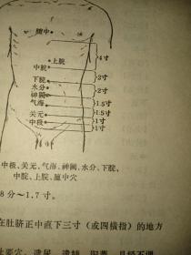 1970年北京中医学院编《针灸临床取穴图解》王方明中医签字，32开