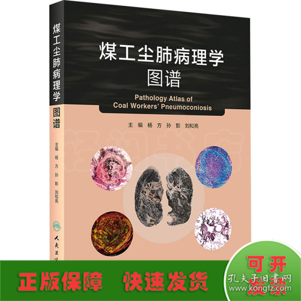 煤工尘肺病理学图谱