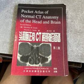 头和脑正常CT解剖袖珍图谱