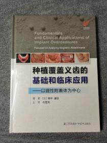 种植覆盖义齿的基础和临床应用------以磁性附着体为中心（精）