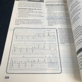 心脏病学  风暴式医学教程 (原版英文)