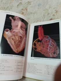 介入治疗解剖学图谱心脏