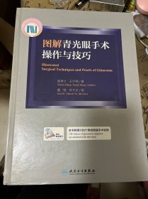 图解青光眼手术操作与技巧