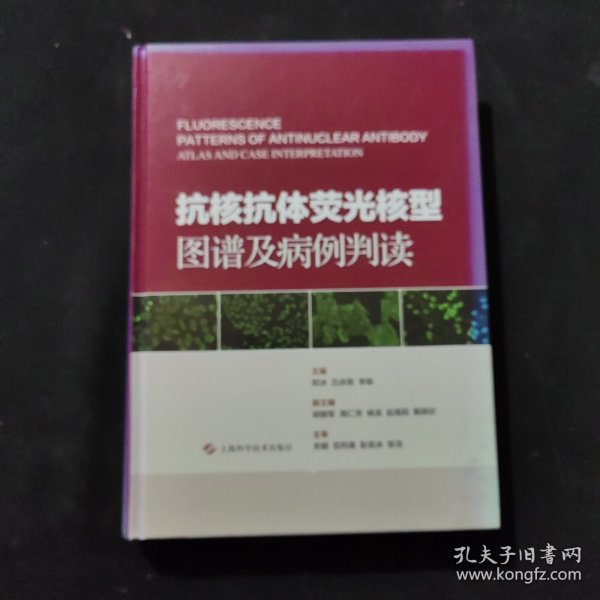 抗核抗体荧光核型图谱及病例判读