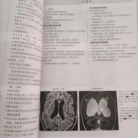 国际权威影像鉴别诊断丛书·影像专家鉴别诊断：颅脑与脊柱脊髓分册