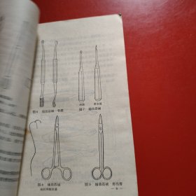 拔牙技术 1975年