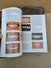 A CLINICAL GUIDE TO Direct Cosmetic Restorations Giomer WITH：牙齿美容修复的临床指南（全新未拆封）