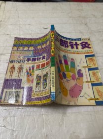 手部针灸