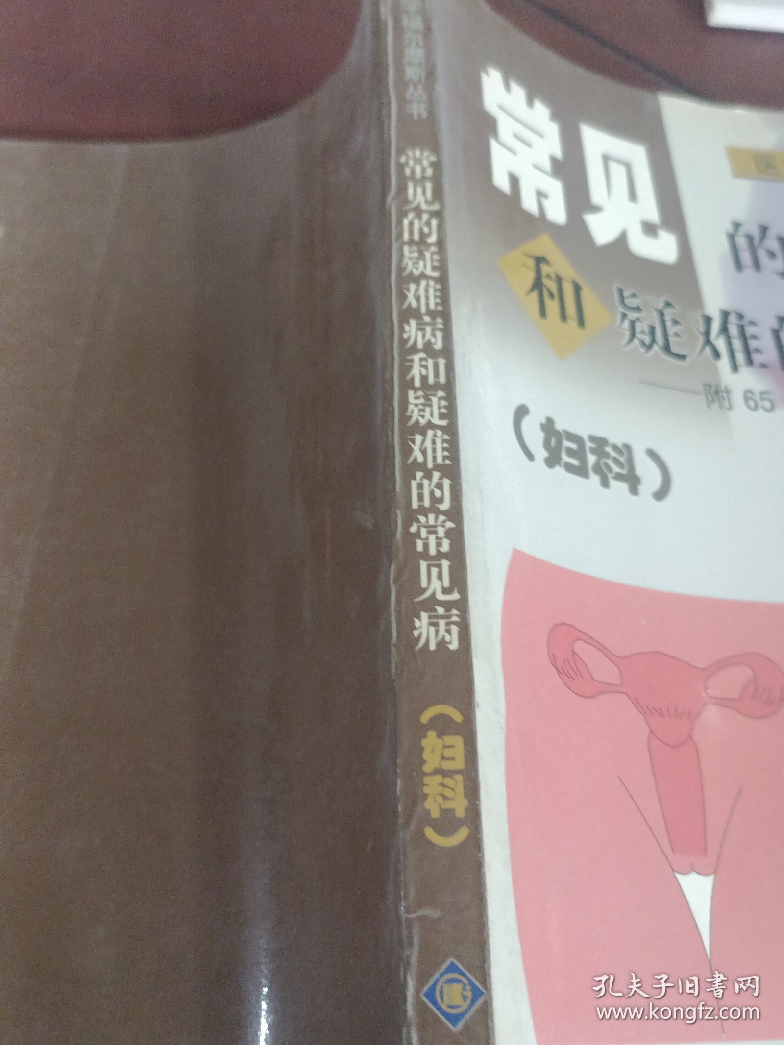 常见的疑难病和疑难的常见病:妇科