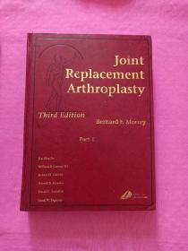 JointReplacementArthroplasty   (Part  I)