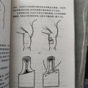 手部创伤的处理