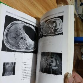 断面解剖与MRI CT ECT对照图谱2