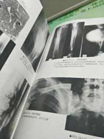 实用骨关节影像诊断学