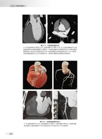 中华影像鉴别诊断学——心血管分册