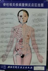 脊柱相关疾病挂图4张