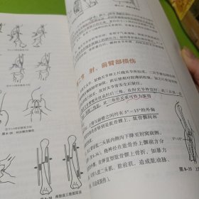 中西医结合骨伤科学——十三五规划 如图现货速发