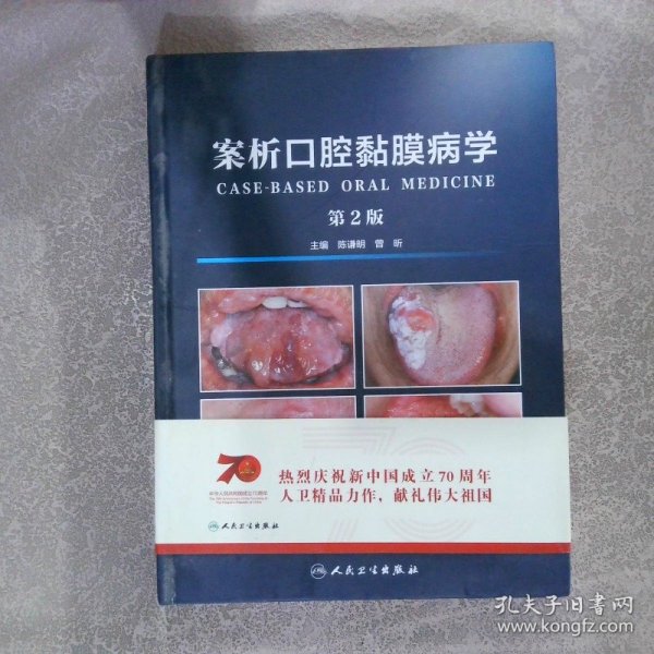 案析口腔黏膜病学（第2版）