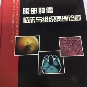 眼部肿瘤临床与组织病理诊断