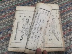 清 中医木刻本《医宗金鉴》存卷84～85 外科心法要诀 一册   内有精美版画48图  较之此书清晚版本的粗糙木刻图  有明显区别