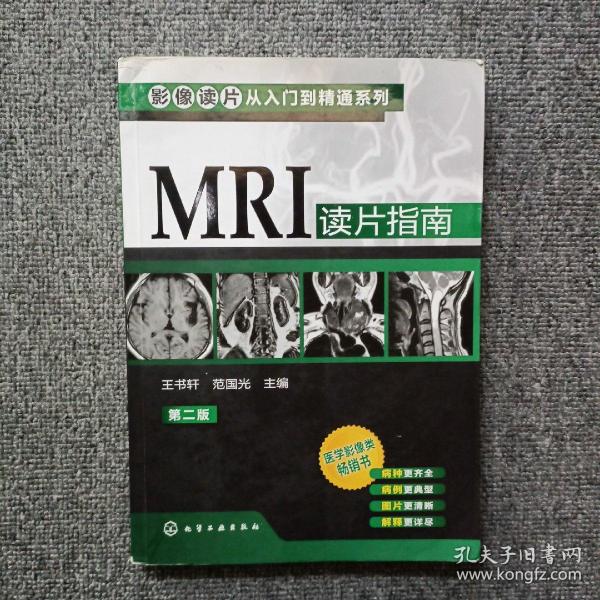 影像读片从入门到精通系列：MRI读片指南（第2版）