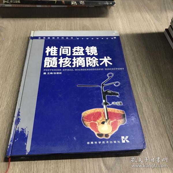 椎间盘镜髓核摘除术