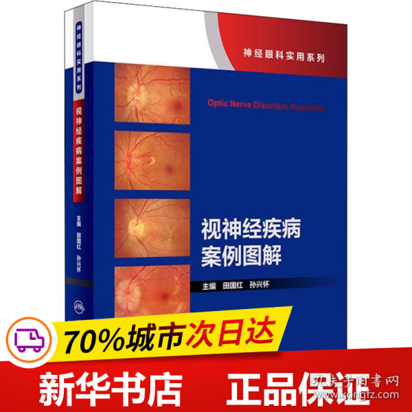 保正版！视神经疾病案例图解9787117269063人民卫生出版社编者:田国红//孙兴怀