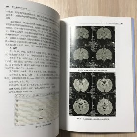 颞叶癫痫的外科问题（辽宁省优秀自然科学著作）