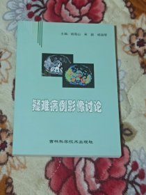 疑难病例影响讨论