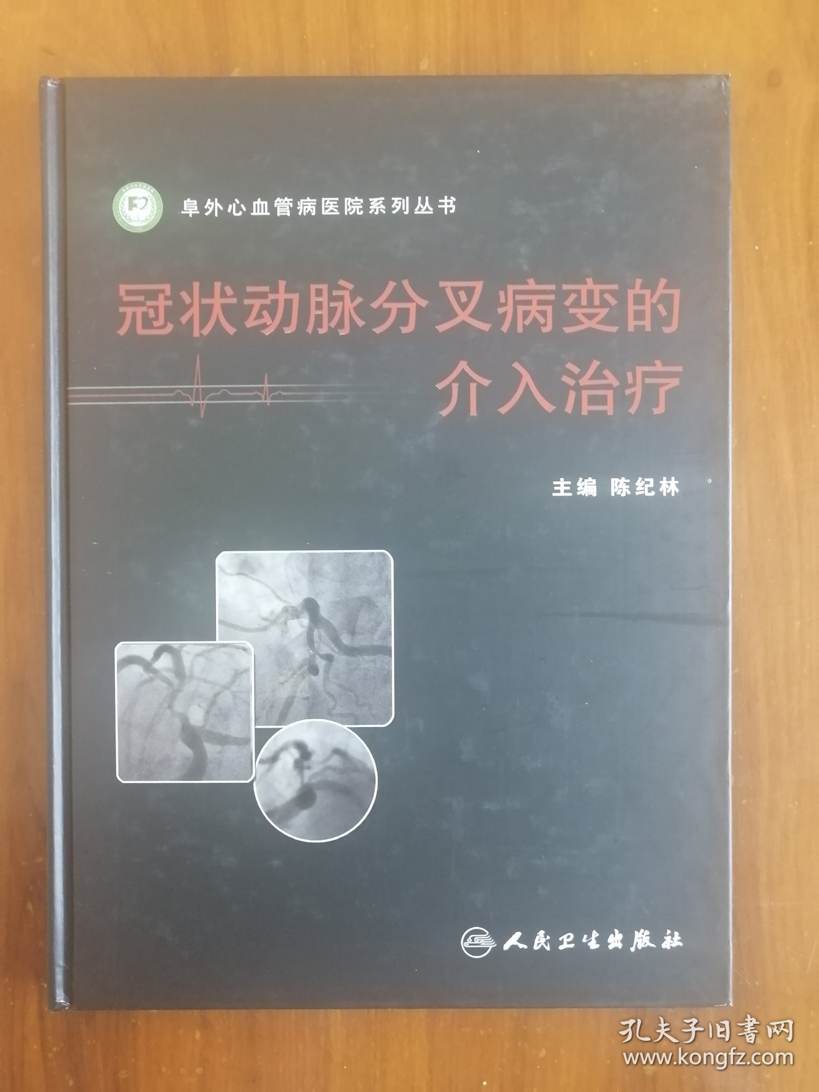 冠状动脉分叉病变的介入治疗